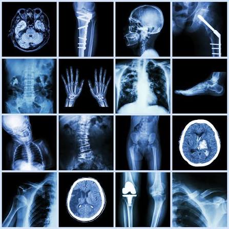 X-Ray